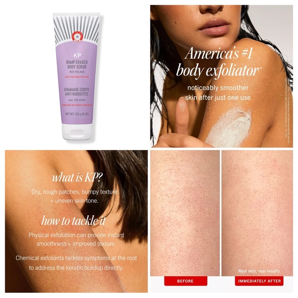 First Aid Beauty KP Bump Eraser Body Scrub Fresh Strawberry- 28.3g(NEW) - Picture 2 of 4